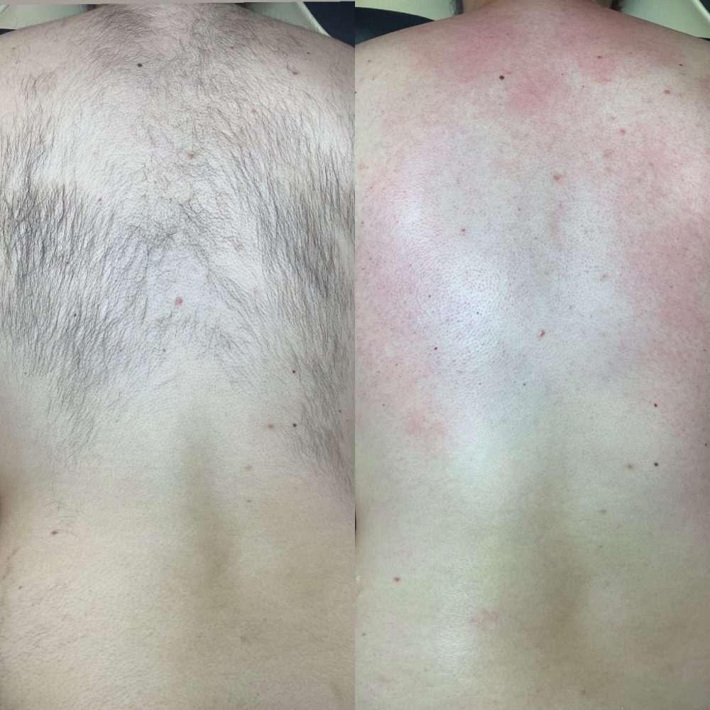 Full Back Wax Las Vegas