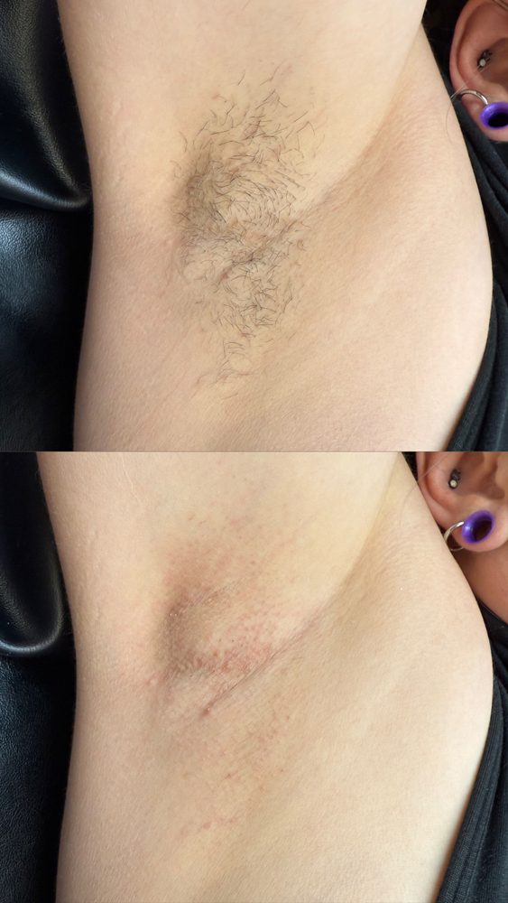 Underarm Wax Las Vegas 2