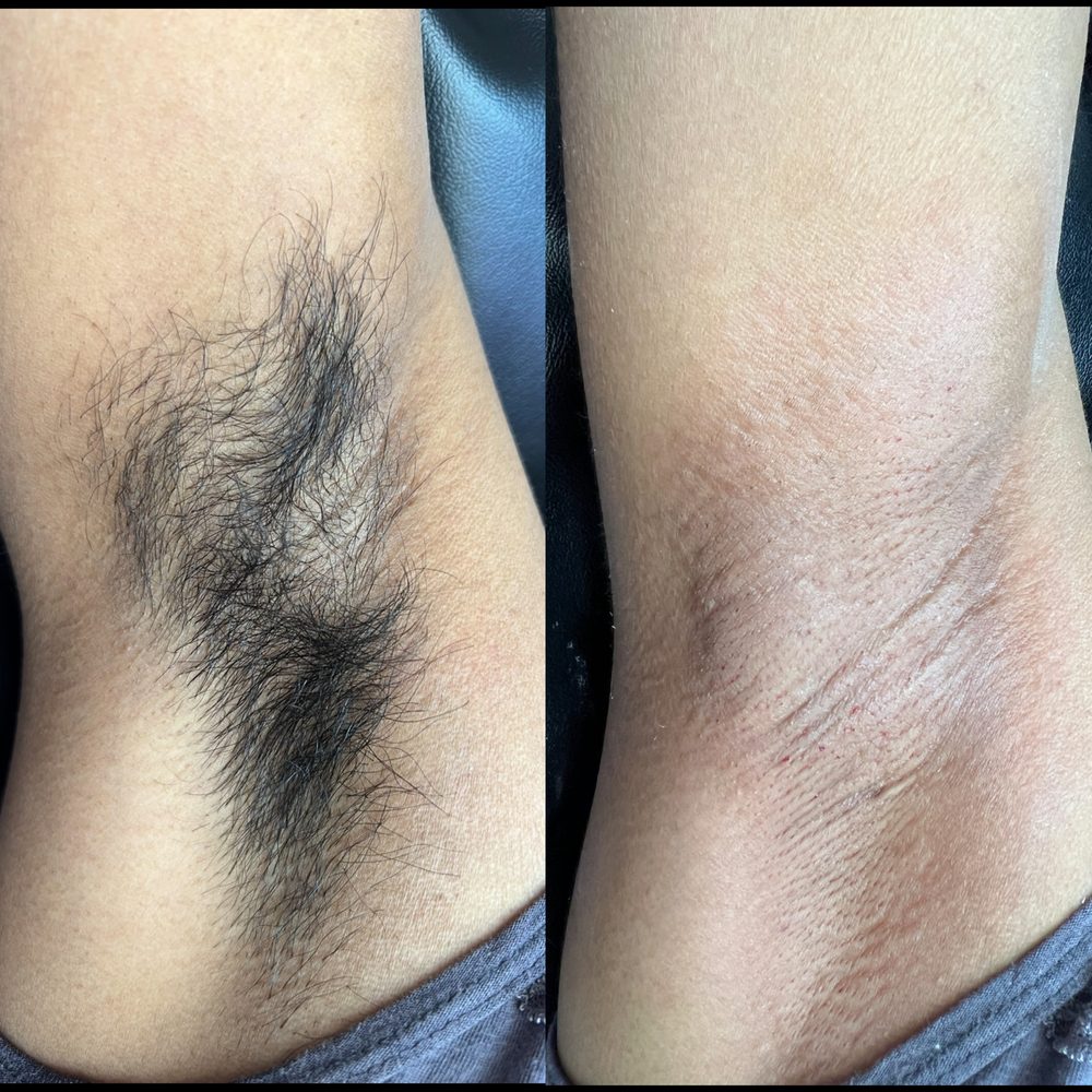 Underarm Wax Las Vegas 3