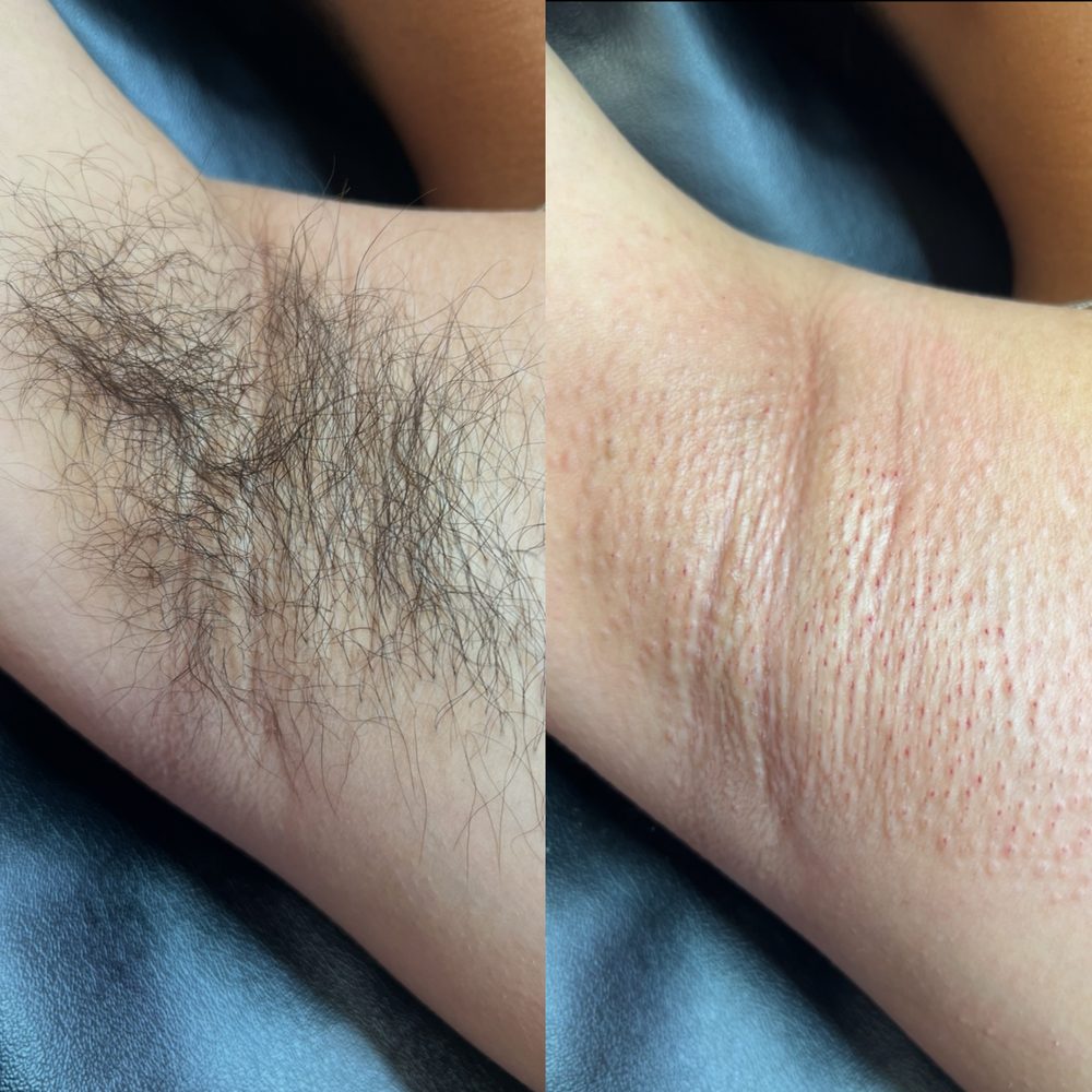 Underarm Wax Las Vegas 4