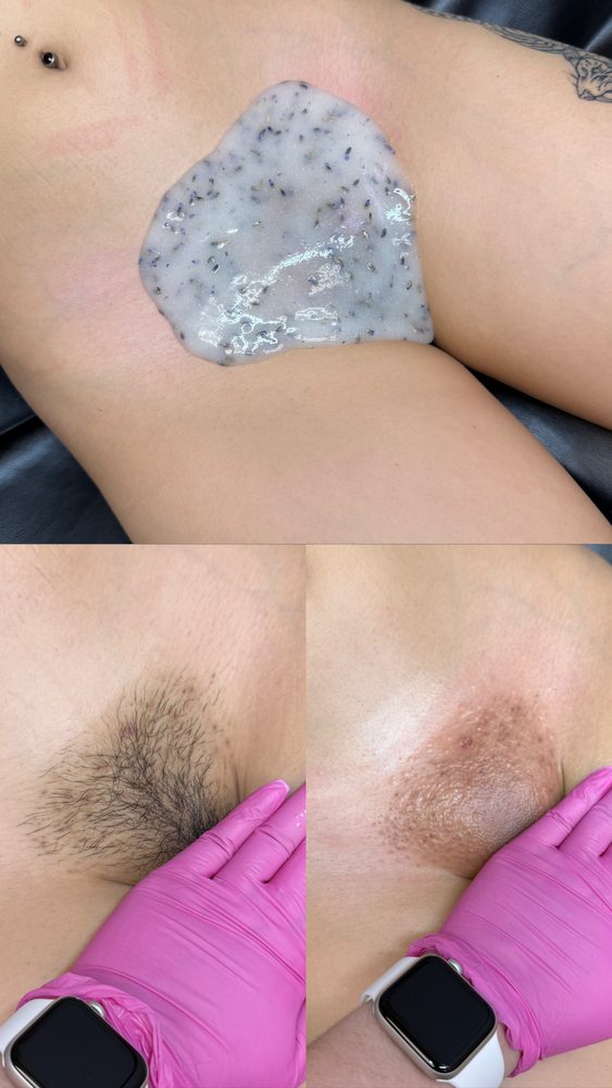 Deluxe Brazilian Wax Las Vegas Before and After 2