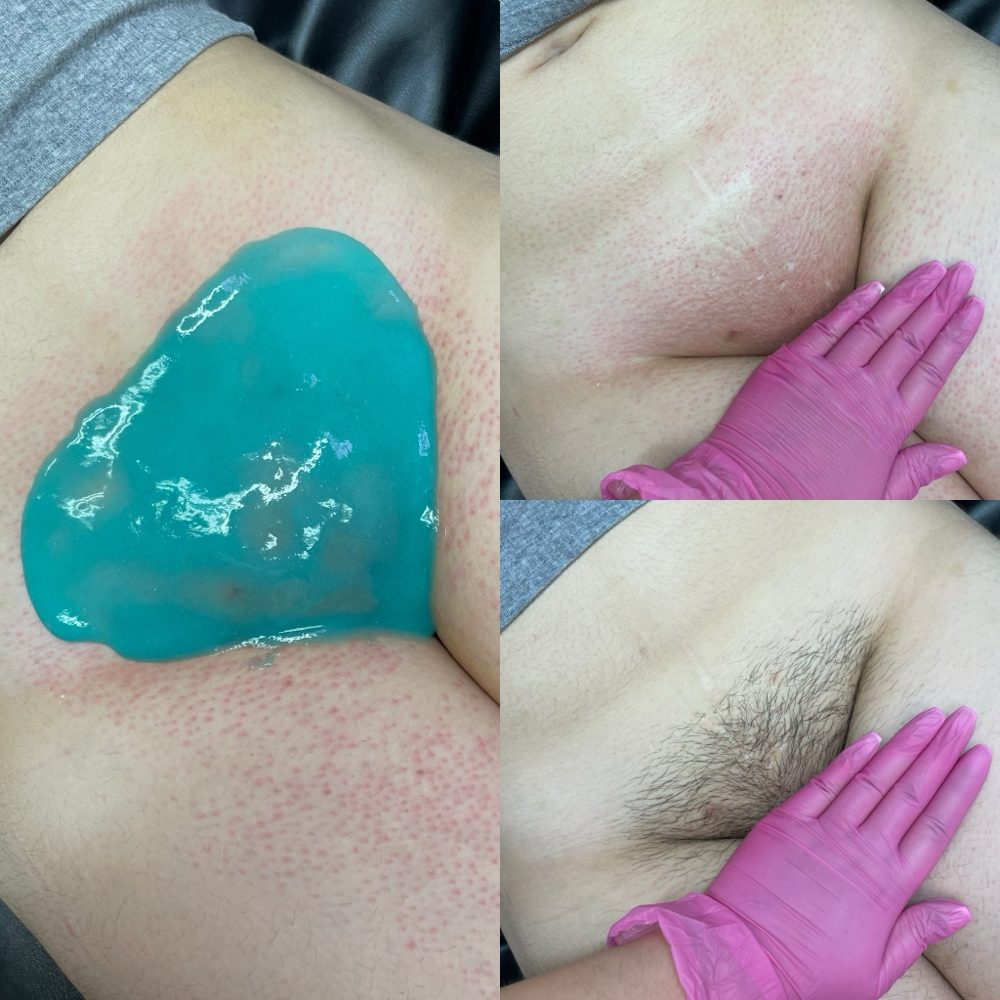 Deluxe Brazilian Wax Las Vegas Before and After 3