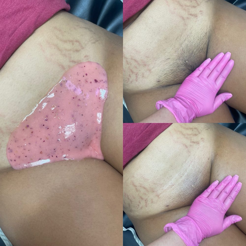 Deluxe Brazilian Wax Las Vegas Before and After 4