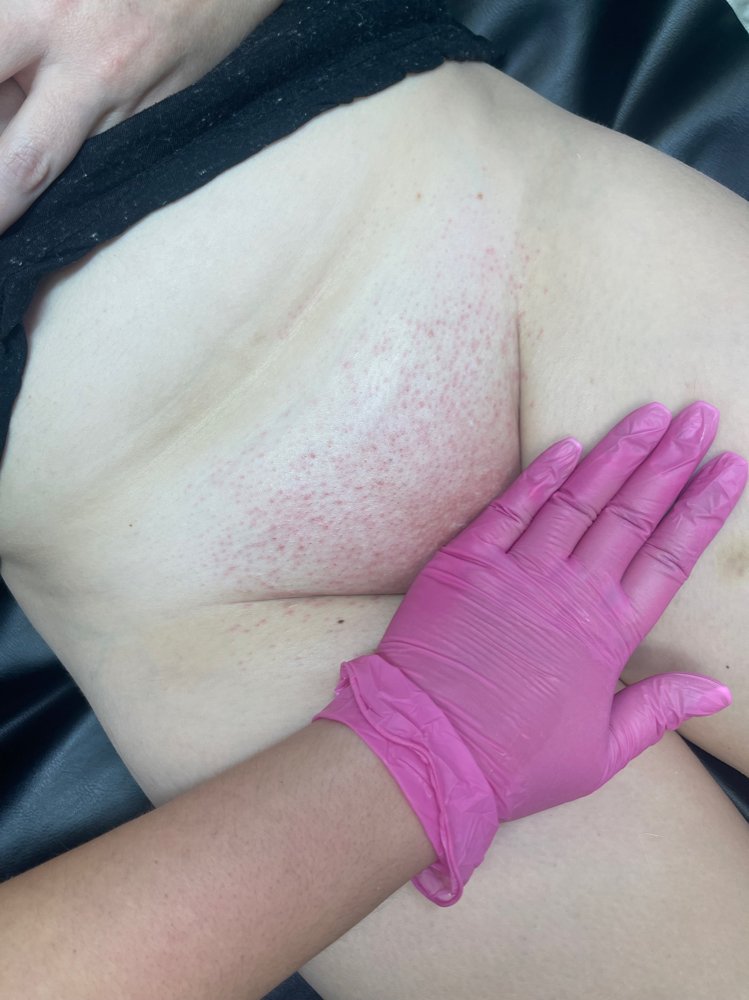 Brazilian clean up wax Las Vegas: smooth skin after a maintenance Brazilian at Pink Crab Wax Bar