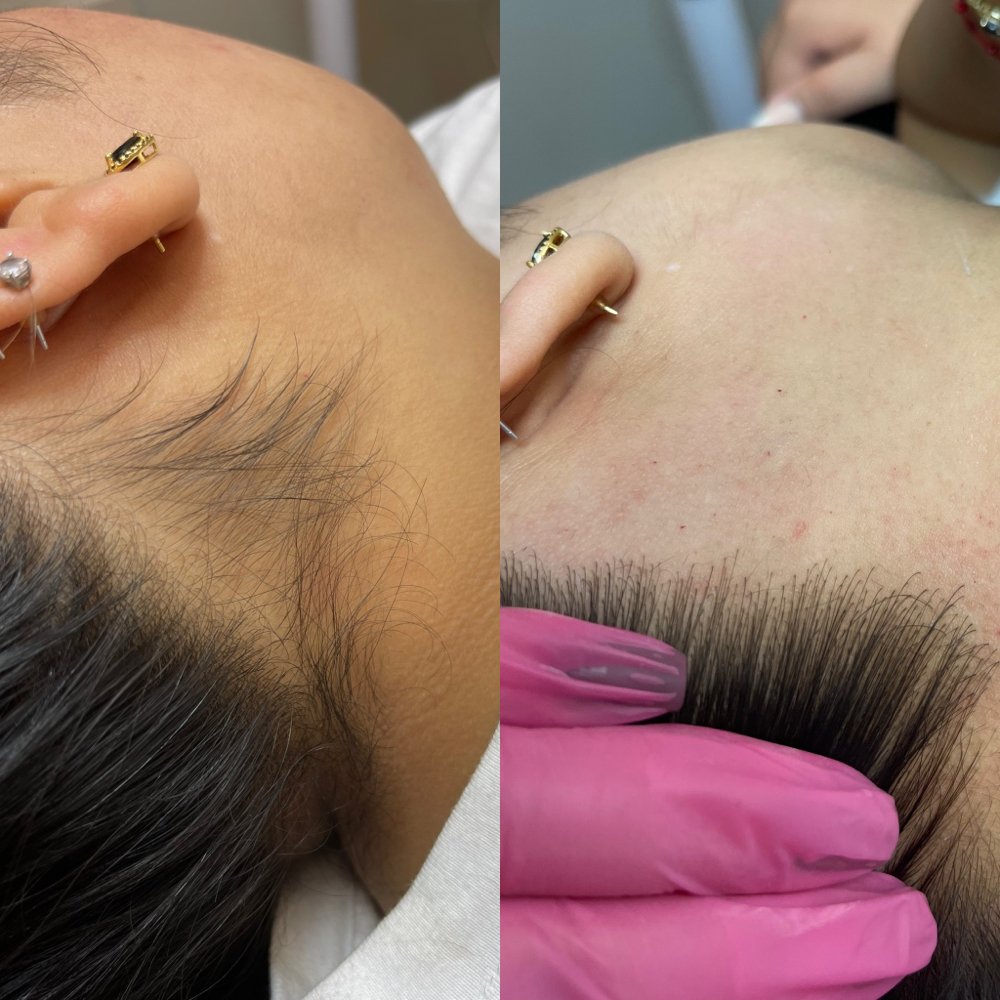 Hairline wax Las Vegas: before and after a clean hairline and neck wax at Pink Crab Wax Bar