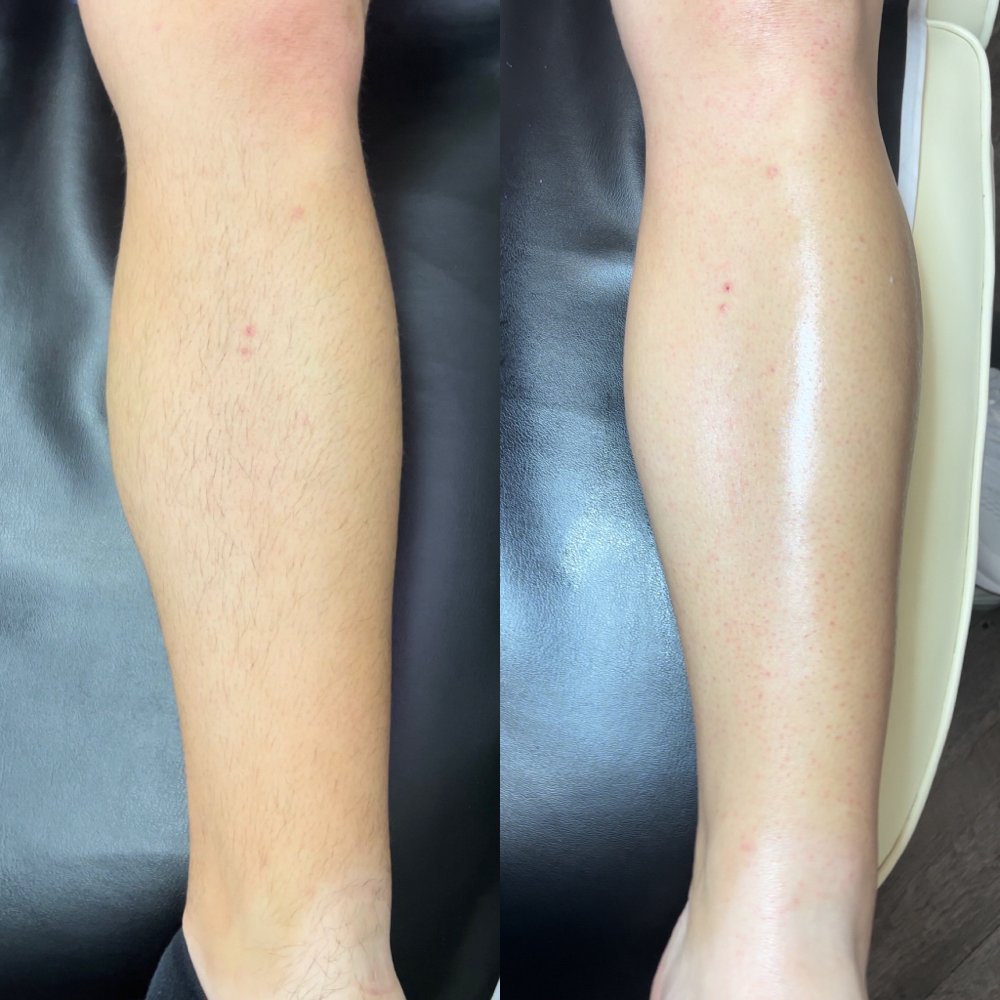 Half leg wax Las Vegas: before and after a lower leg wax on both legs at Pink Crab Wax Bar