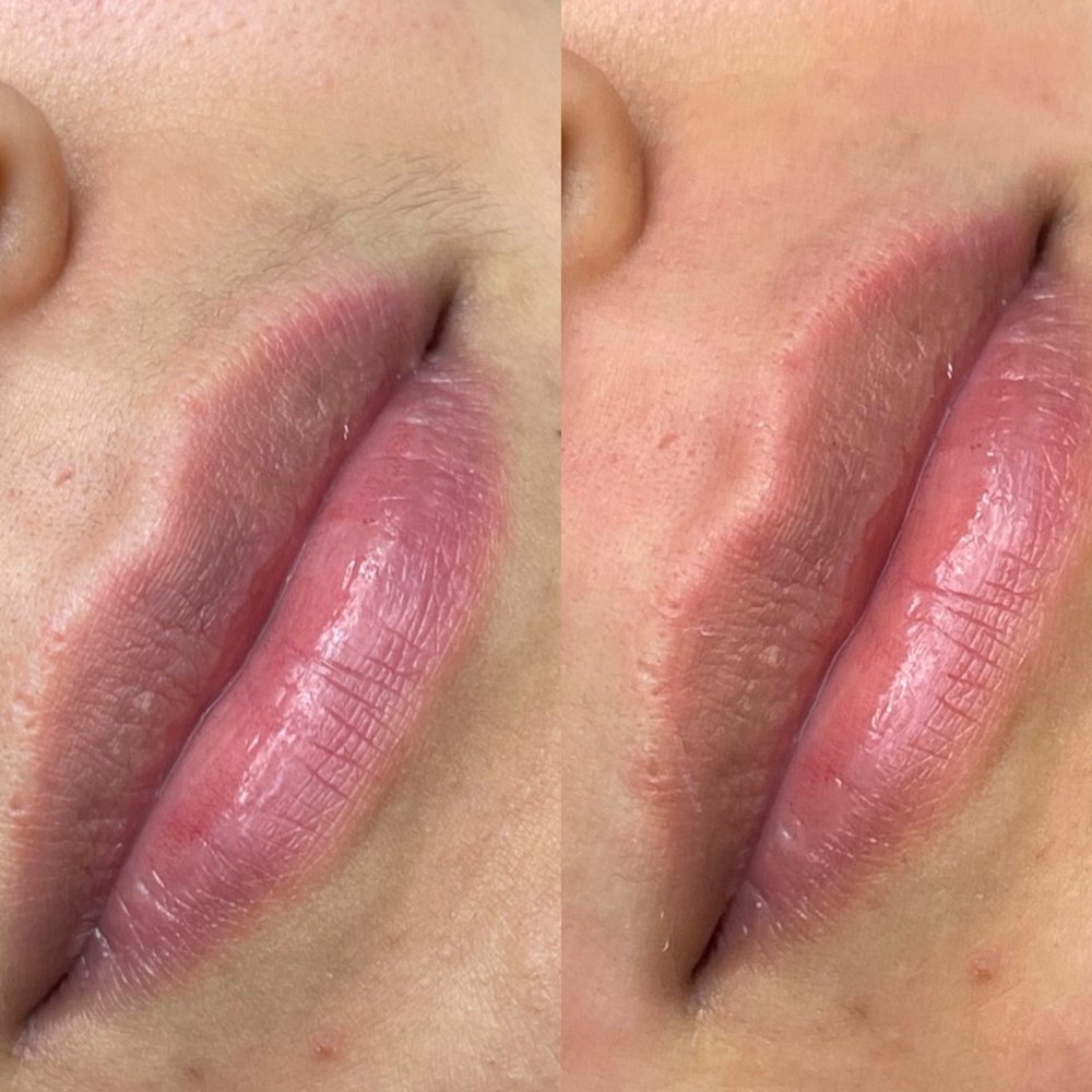 Lip wax Las Vegas: smooth upper lip after a hard wax at Pink Crab Wax Bar